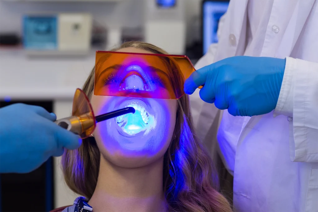 Paciente recibe blanqueamiento dental con luz LED en la clínica Gutiérrez Odontólogos, dentista recomendado en Almería