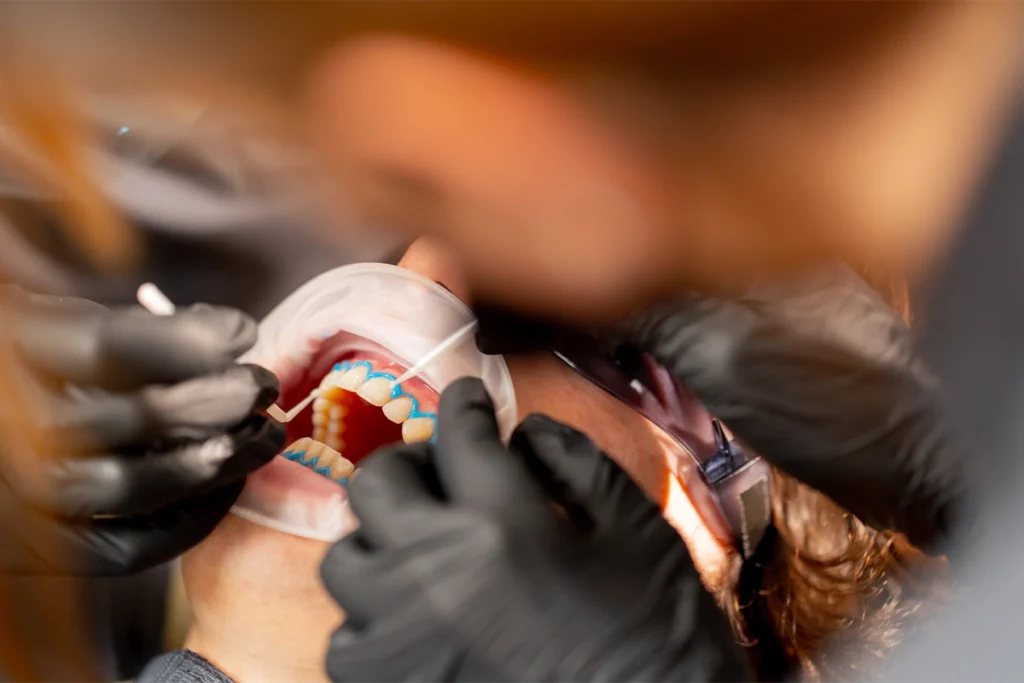 Dentista recomendado en Almería aplica un tratamiento periodontal mínimamente invasivo para cuidar la salud de las encías en la clínica dental Gutiérrez Odontólogos